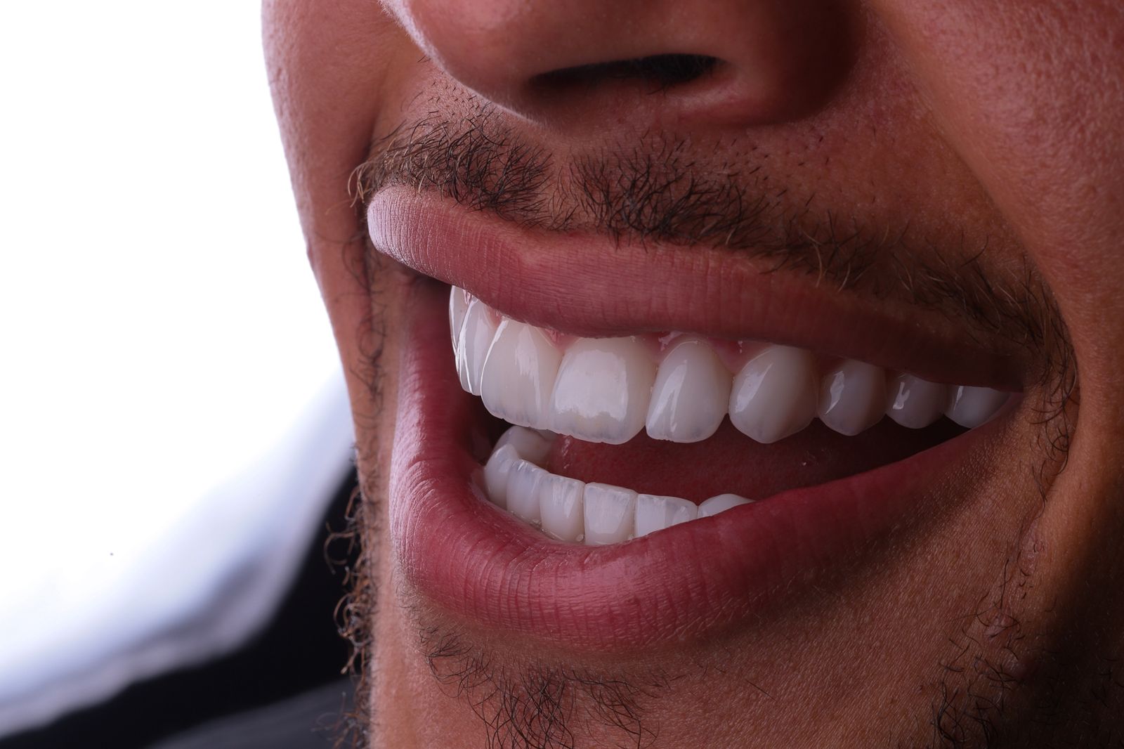 WhatsApp-Image-2026-01-06-at-11.13.17-1 Clínica Viotto aponta tendência 2026: o sorriso natural se consolida como o novo luxo