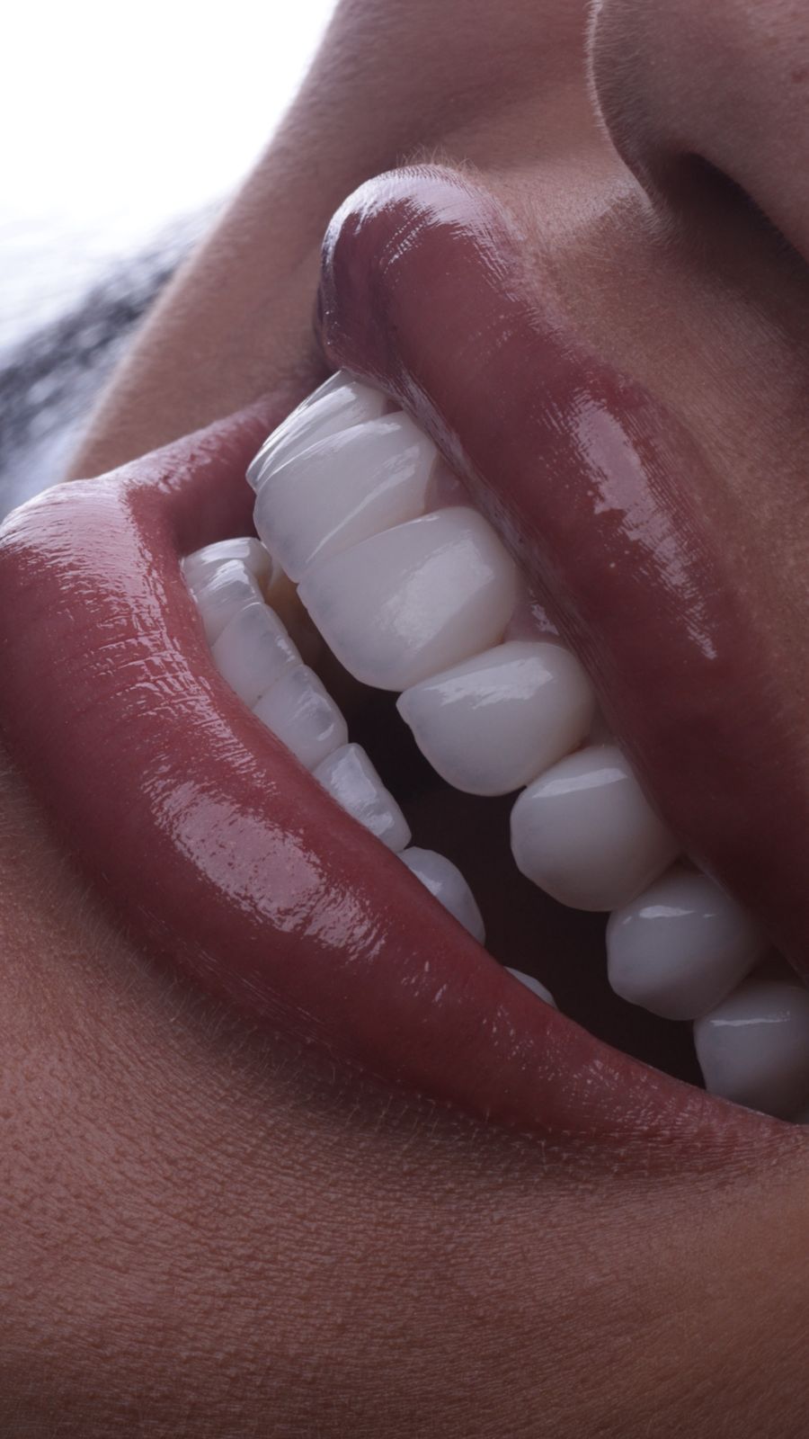 WhatsApp-Image-2026-01-06-at-11.13.17 Clínica Viotto aponta tendência 2026: o sorriso natural se consolida como o novo luxo